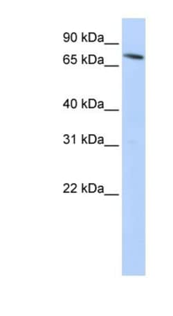 NRAMP2/SLC11A2/DMT1 Antibody, Novus Biologicals 0.05mg; Unlabeled:Antibodies,