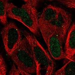 CYP11A1 Antibody, Novus Biologicals:Antibodies:Primary Antibodies