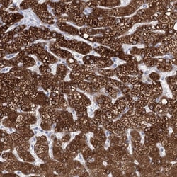 CYP11A1 Antibody, Novus Biologicals:Antibodies:Primary Antibodies