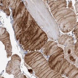 NRAP Antibody, Novus Biologicals:Antibodies:Primary Antibodies