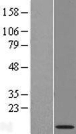 Novus Biologicals&trade;&nbsp;NRARP Overexpression Lysate