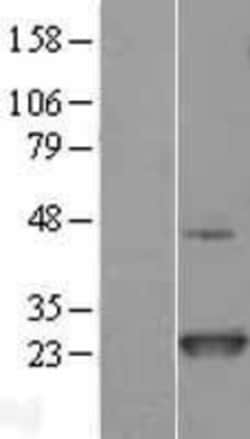Novus Biologicals&trade;&nbsp;NRAS Overexpression Lysate