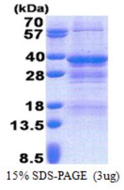 Novus Biologicals&trade;&nbsp;Recombinant Human NRBF2 His Protein
