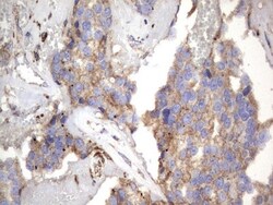 NRBF2 Antibody (OTI1A2), Novus Biologicals 0.1mL; Unlabeled:Antibodies,