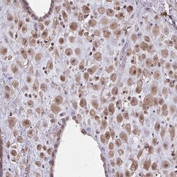 NRBF2 Antibody, Novus Biologicals 25 &mu;L, Unlabeled:Antibodies, Polyclonal