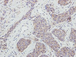 NRBP1 Antibody, Novus Biologicals 0.1 mL | Buy Online | Novus Biologicals | Fisher Scientific