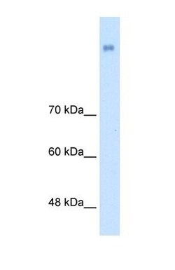 NrCAM Antibody, Novus Biologicals 0.1mg; Unlabeled:Antibodies, Polyclonal