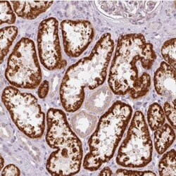 NRDE2 Antibody, Novus Biologicals 0.1mL; Unlabeled:Antibodies, Polyclonal