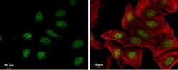 Nrf2 Antibody, Novus Biologicals 0.1mg; Unlabeled:Antibodies, Polyclonal