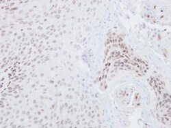 Nrf2 Antibody, Novus Biologicals 0.1mg; Unlabeled:Antibodies, Polyclonal