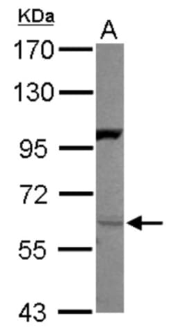 Neuregulin-1/NRG1 Antibody, Novus Biologicals 0.1mL; Unlabeled:Antistoffer