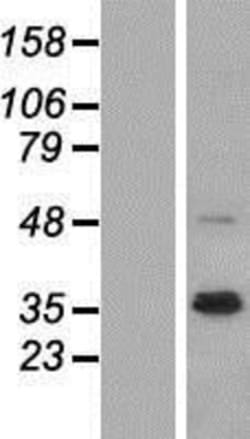 Novus Biologicals&trade;&nbsp;Neuregulin-1/NRG1 Overexpression Lysate