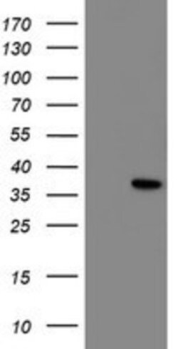 NRIP3 Antibody (OTI1G6), Novus Biologicals 0.1mL; Unlabeled:Antibodies,
