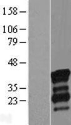 Novus Biologicals™ NRIP3 Overexpression Lysate