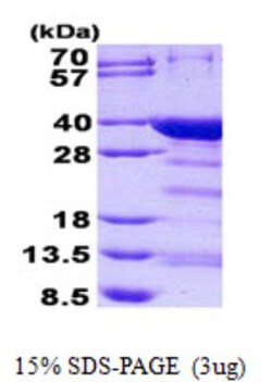 Novus Biologicals Recombinant Human NRIP3 His Protein 0.05 mg | Buy Online | Novus Biologicals&trade; | Fisher Scientific