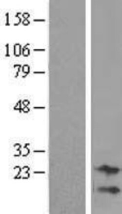 Novus Biologicals&trade;&nbsp;NRK1 Overexpression Lysate