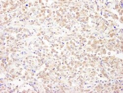 NRSF Antibody, Novus Biologicals 0.1mg; Unlabeled:Antibodies, Polyclonal