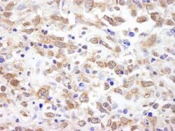 NRSF Antibody, Novus Biologicals 0.1mg; Unlabeled:Antibodies, Polyclonal