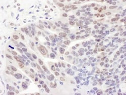 NRSF Antibody, Novus Biologicals 0.1mg; Unlabeled:Antibodies, Polyclonal