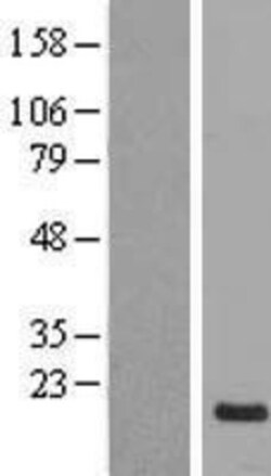Novus Biologicals&trade;&nbsp;NRSN1 Overexpression Lysate