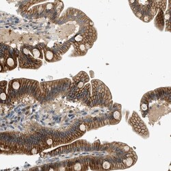 NRSN2 Antibody, Novus Biologicals 0.1mL; Unlabeled:Antibodies, Polyclonal