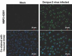 Dengue Virus NS2B Antibody, Novus Biologicals 0.1mL:Antibodies, Polyclonal