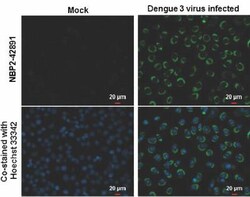 Dengue Virus NS2B Antibody, Novus Biologicals 0.1mL:Antibodies, Polyclonal