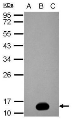 Dengue Virus NS2B Antibody, Novus Biologicals 0.1mL:Antibodies, Polyclonal