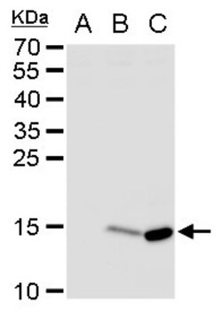 Dengue Virus NS2B Antibody, Novus Biologicals 0.1mL:Antibodies, Polyclonal