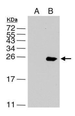Dengue Virus NS4B Antibody, Novus Biologicals 0.1mL:Antibodies, Polyclonal