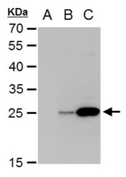 Dengue Virus NS4B Antibody, Novus Biologicals 0.1mL:Antibodies, Polyclonal