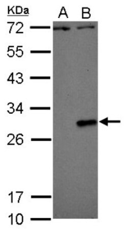 Dengue Virus NS4B Antibody, Novus Biologicals 0.1mL:Antibodies, Polyclonal