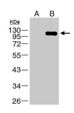 Dengue Virus NS5 Antibody, Novus Biologicals 0.1mL:Antibodies, Polyclonal