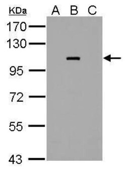 Dengue Virus NS5 Antibody, Novus Biologicals 0.1mL:Antibodies, Polyclonal