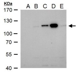 Dengue Virus NS5 Antibody, Novus Biologicals 0.1mL:Antibodies, Polyclonal