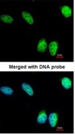 NSD3 Antibody, Novus Biologicals 0.1mg; Unlabeled:Antibodies, Polyclonal