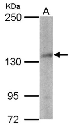 NSD3 Antibody, Novus Biologicals 0.1mg; Unlabeled:Antibodies, Polyclonal