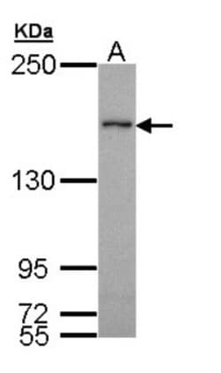NSD3 Antibody, Novus Biologicals 0.1mg; Unlabeled:Antibodies, Polyclonal