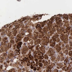 NSDHL Antibody, Novus Biologicals:Antibodies:Primary Antibodies