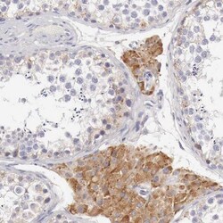 NSDHL Antibody, Novus Biologicals:Antibodies:Primary Antibodies