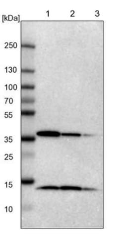 NSDHL Antibody, Novus Biologicals:Antibodies:Primary Antibodies