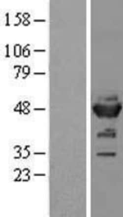 Novus Biologicals&trade;&nbsp;Enolase 2/Neuron-specific Enolase Overexpression Lysate