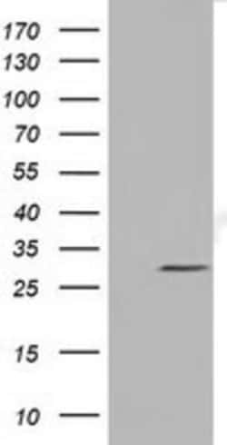 Nse2 Antibody (OTI6A6), Novus Biologicals 0.1 mL | Buy Online | Novus Biologicals | Fisher Scientific