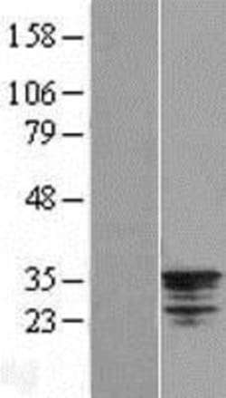 Novus Biologicals™ Nse2 Overexpression Lysate