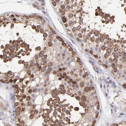 NSF Antibody, Novus Biologicals:Antibodies:Primary Antibodies