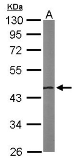 NSFL1C Antibody, Novus Biologicals 0.1mg; Unlabeled:Antibodies, Polyclonal