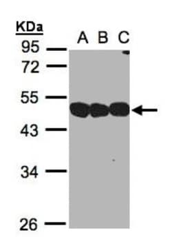 NSFL1C Antibody, Novus Biologicals 0.1mg; Unlabeled:Antibodies, Polyclonal