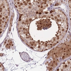 NSFL1C Antibody, Novus Biologicals:Antibodies:Primary Antibodies