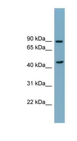 nSMase Antibody, Novus Biologicals:Antibodies:Primary Antibodies