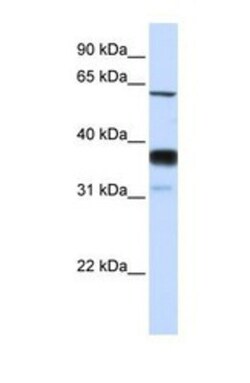 SMPD3/NSMase2 Antibody, Novus Biologicals 0.05mg; Unlabeled:Antibodies,